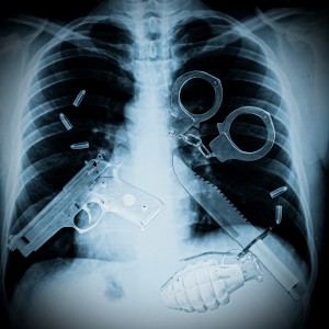 radiografia posibles (2)